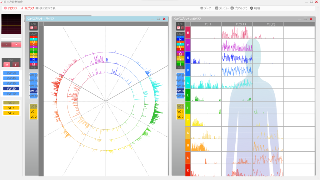 声診断ソフトにより声をとった波形、縦グラフと人体図が表示されている