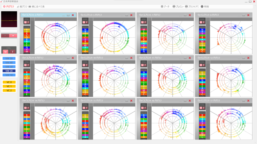 声診断の声の波形、円グラフ12種類